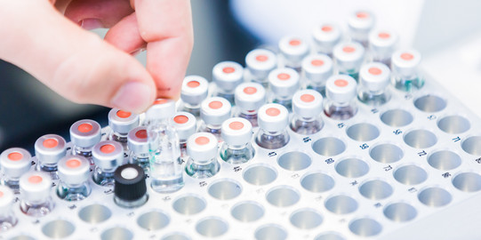Close-up laboratory_02 Several sample vessels in a container in the laboratory.